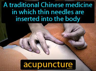 Acupuncture Meaning