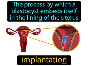 Implantation Meaning
