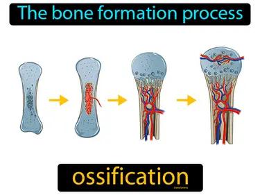 Ossification Meaning