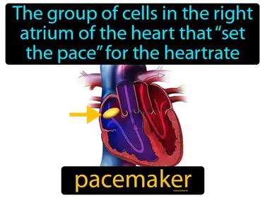 Pacemaker Meaning