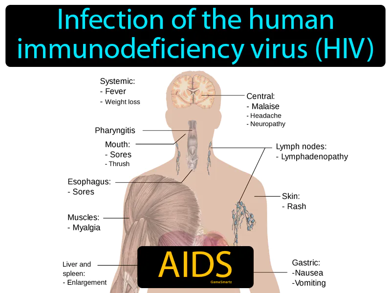 AIDS Definition AIDS Definition