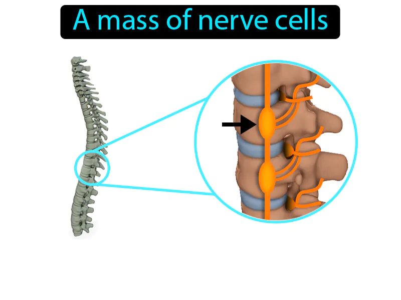 Ganglion Definition Ganglion Definition