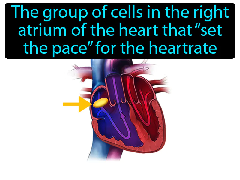 Pacemaker Definition Pacemaker Definition