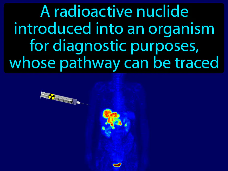 Radiotracer Definition